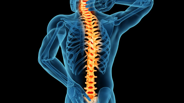 Spinal Stenosis: Causes, Signs & Treatment Options