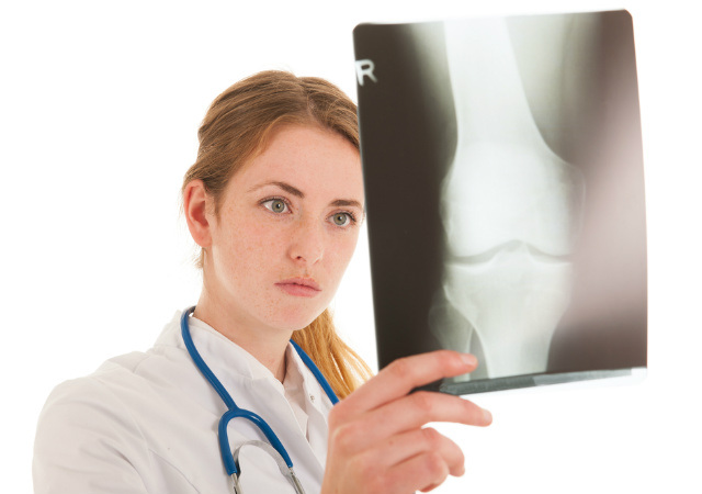 Quicken Your Bone Healing With These Supplements
