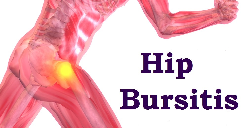 Bursitis occurs in many areas of the body.